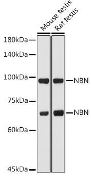 Anti-NBN Antibody (CAB0783)[KO Validated]