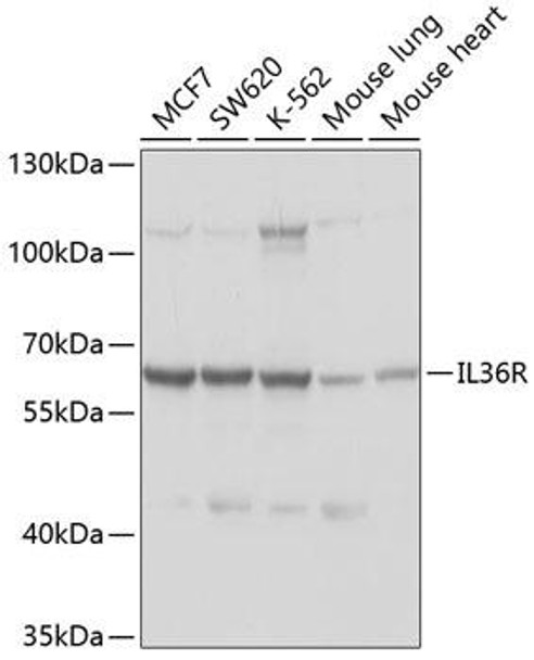 Anti-IL-36R Antibody (CAB10090)