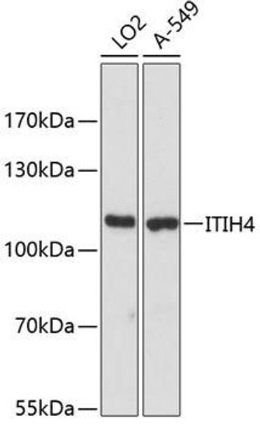 Anti-ITIH4 Antibody (CAB12807)