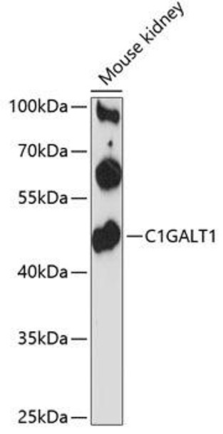 Anti-C1GALT1 Antibody (CAB12865)