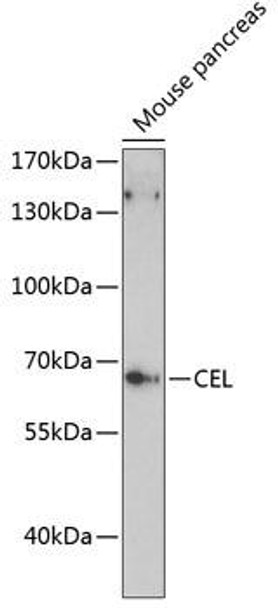 Anti-CEL Antibody (CAB13011)