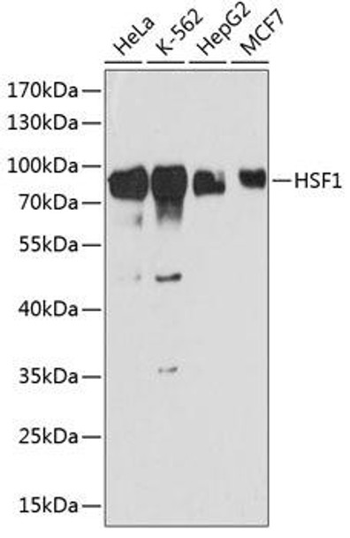 Anti-HSF1 Antibody (CAB13765)