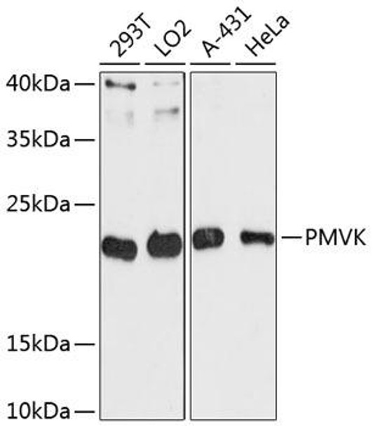 Anti-PMVK Antibody (CAB13866)