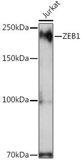 Anti-ZEB1 Antibody (CAB1500)[KO Validated]