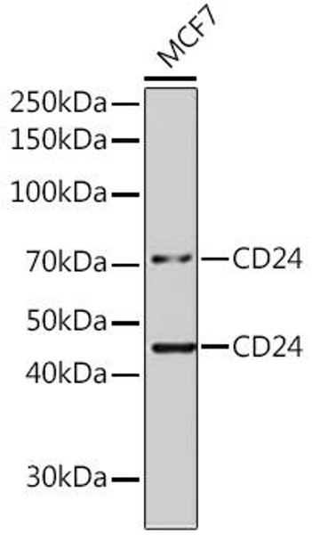 Anti-CD24 Antibody (CAB17444)