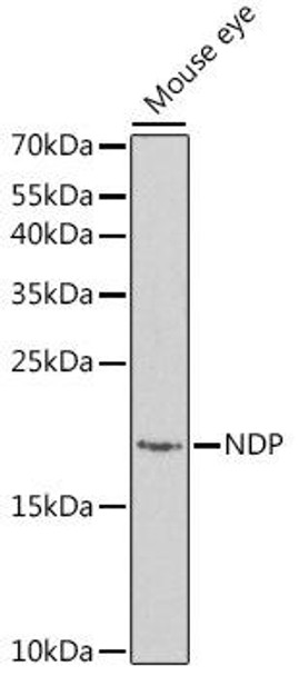 Anti-NDP Antibody (CAB1964)