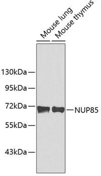 Anti-NUP85 Antibody (CAB3504)