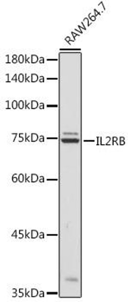 Anti-IL-2RB Antibody (CAB6207)