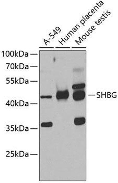 Anti-SHBG Antibody (CAB7450)
