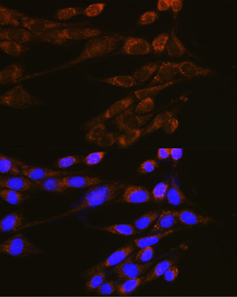 Anti-DNM2 Antibody (CAB7890)