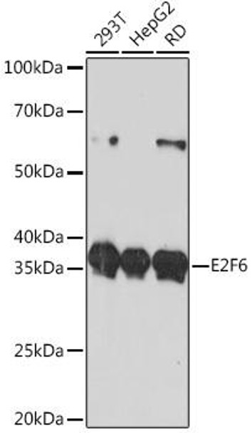 Anti-E2F6 Antibody (CAB11546)