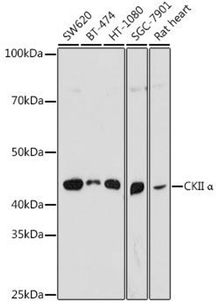 Anti-CKII Alpha Antibody (CAB17466)