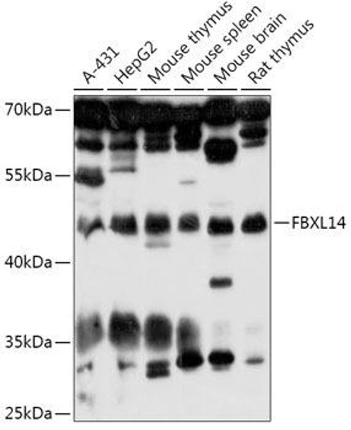 Anti-FBXL14 Antibody (CAB17832)