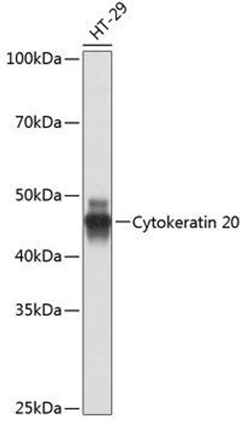 Anti-Cytokeratin 20 Antibody (CAB19041)