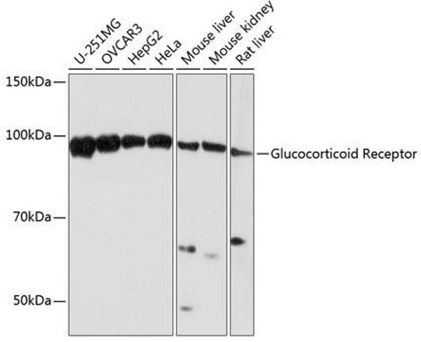 Anti-Glucocorticoid Receptor Antibody (CAB19583)