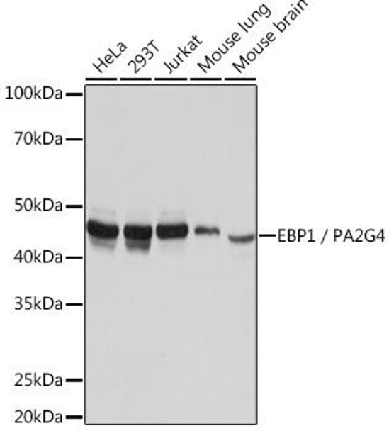 Anti-EBP1 / PA2G4 Antibody (CAB5114)