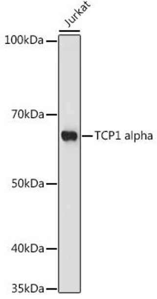 Anti-TCP1 alpha Antibody (CAB3887)