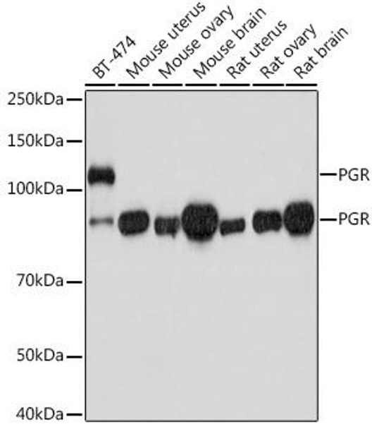Anti-PGR Antibody (CAB0321)