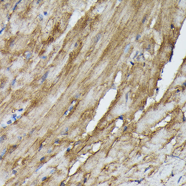 Anti-SOCS3 Antibody (CAB0694)