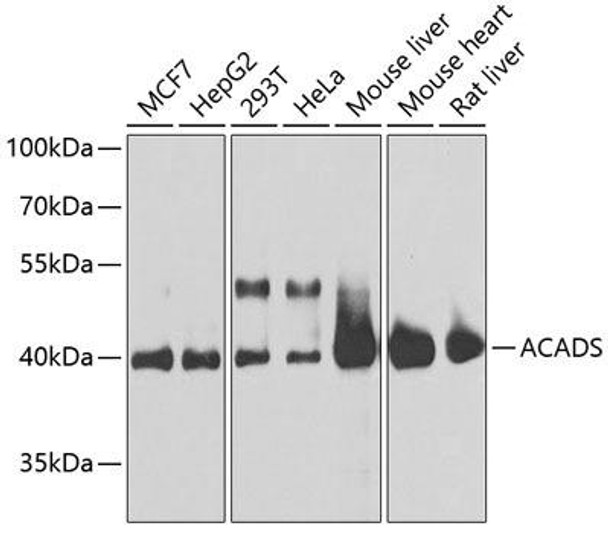 Anti-ACADS Antibody (CAB0945)