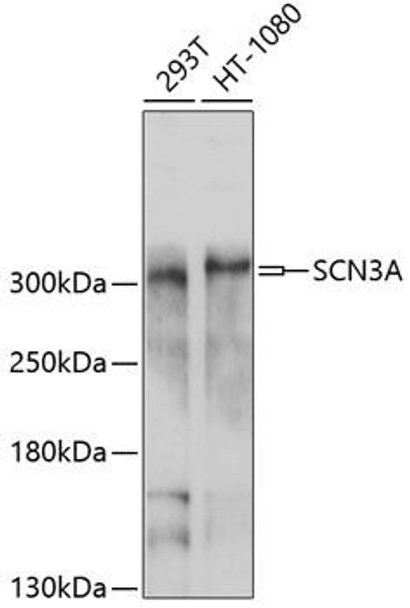 Anti-SCN3A Antibody (CAB10072)