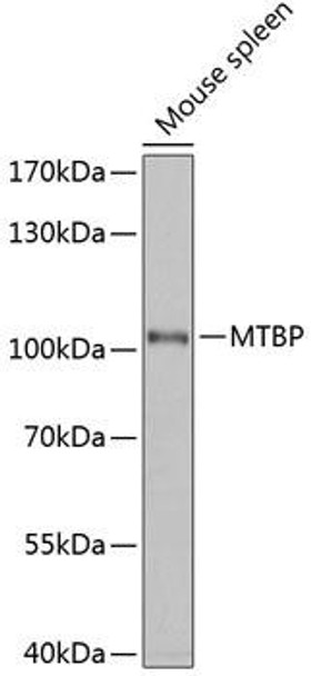 Anti-MTBP Antibody (CAB12363)