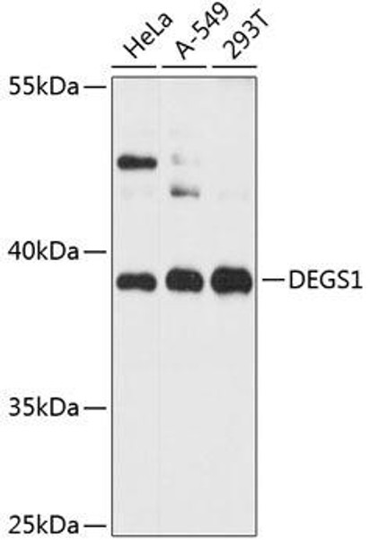 Anti-DEGS1 Antibody (CAB12648)