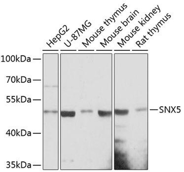 Anti-SNX5 Antibody (CAB13160)
