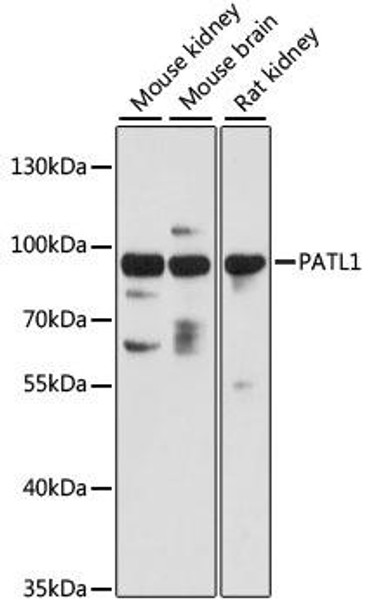 Anti-PATL1 Antibody (CAB13170)