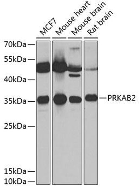 Anti-PRKAB2 Antibody (CAB13341)