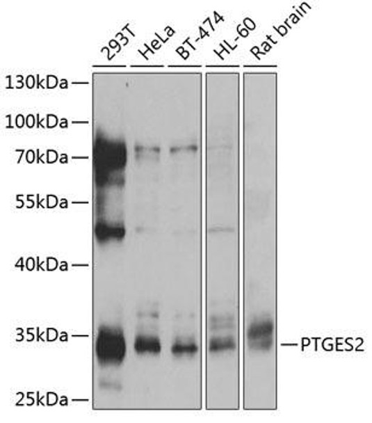 Anti-PTGES2 Antibody (CAB13440)