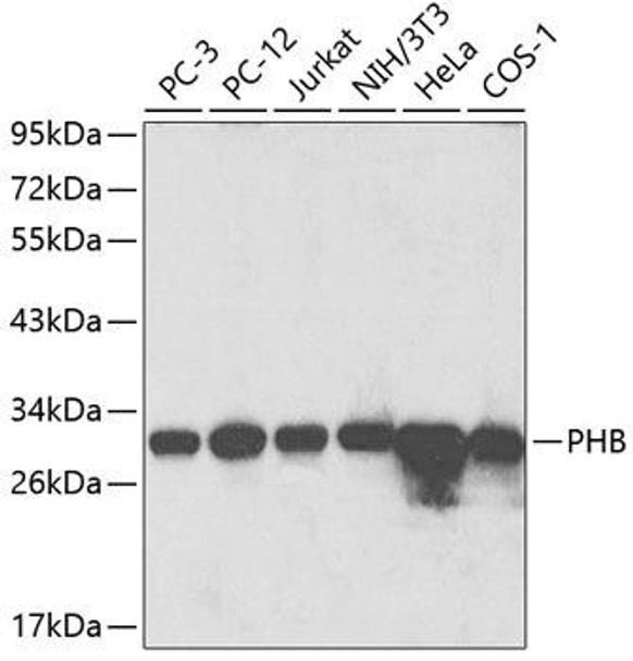 Anti-PHB Antibody (CAB13526)