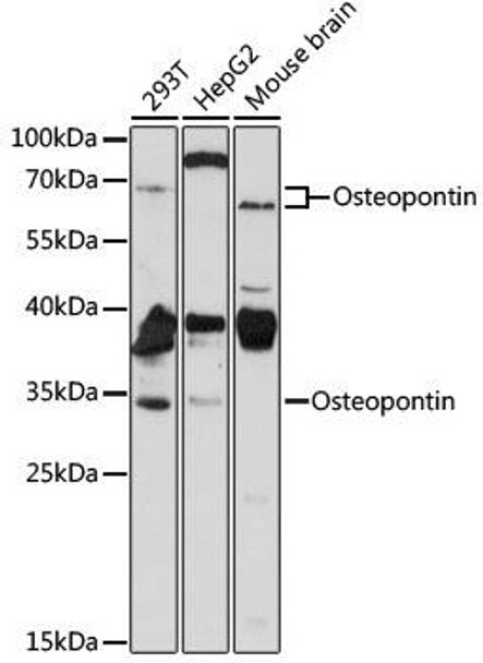 Anti-SPP1 Antibody (CAB1361)