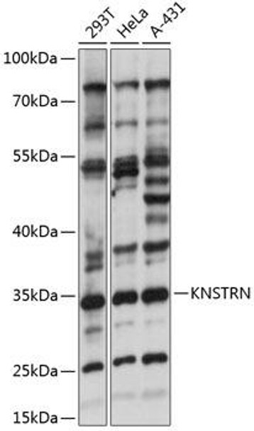 Anti-KNSTRN Antibody (CAB14306)