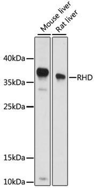 Anti-RHD Antibody (CAB15092)