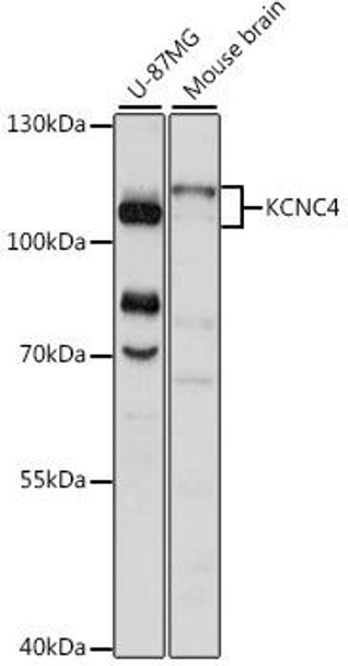 Anti-KCNC4 Antibody (CAB15682)