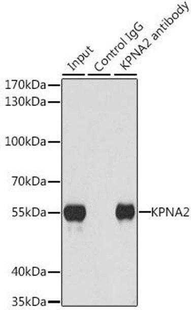 Anti-KPNA2 Antibody (CAB1623)