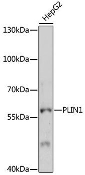 Anti-PLIN1 Antibody (CAB16295)