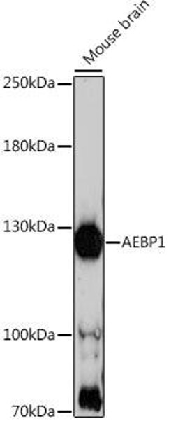 Anti-AEBP1 Antibody (CAB16340)