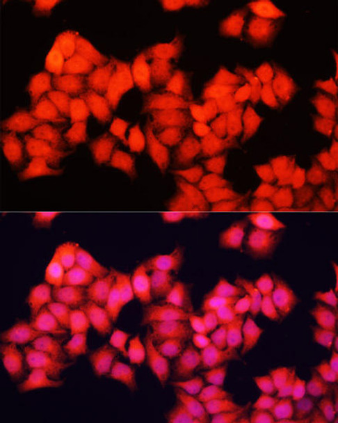 Anti-ARAF Antibody (CAB16346)