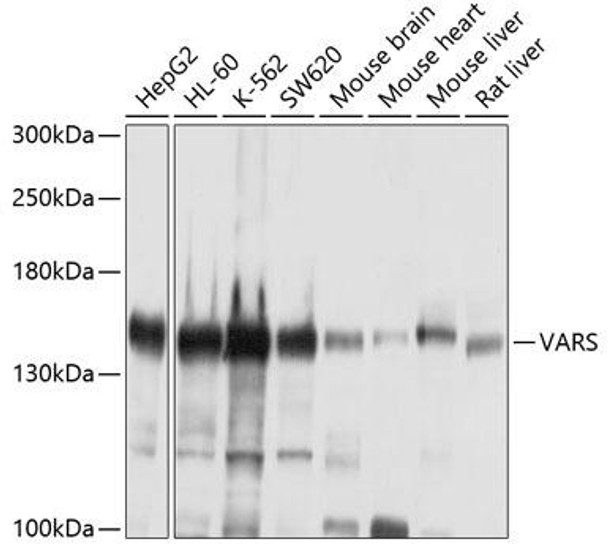 Anti-VARS Antibody (CAB4182)