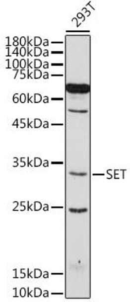 Anti-SET Antibody (CAB6212)