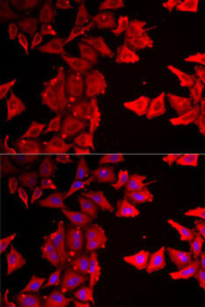 Anti-THRSP Antibody (CAB7232)