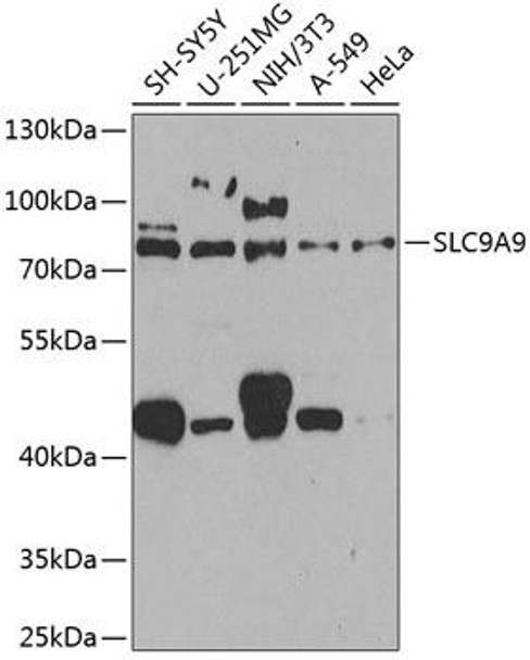 Anti-SLC9A9 Antibody (CAB8323)