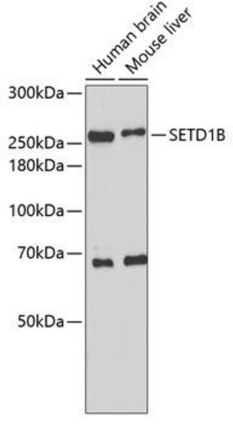 Anti-SETD1B Antibody (CAB2300)