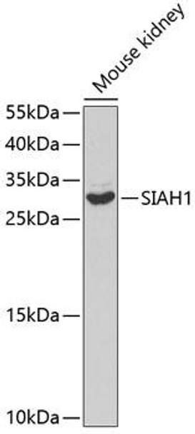 Anti-SIAH1 Antibody (CAB2494)