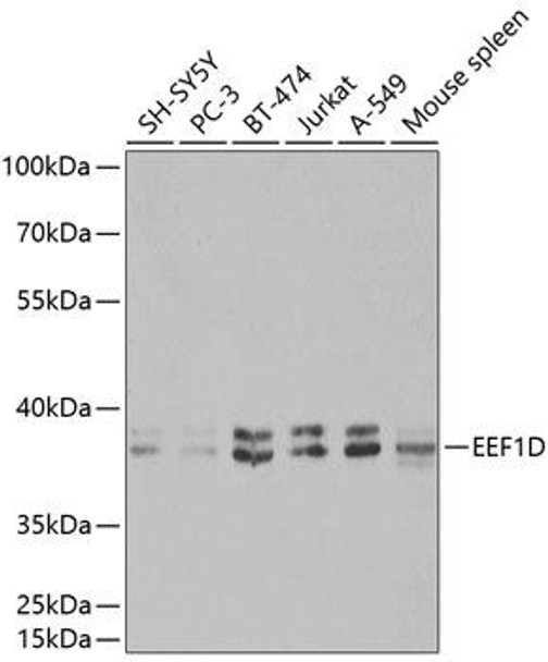 Anti-EEF1D Antibody (CAB2509)