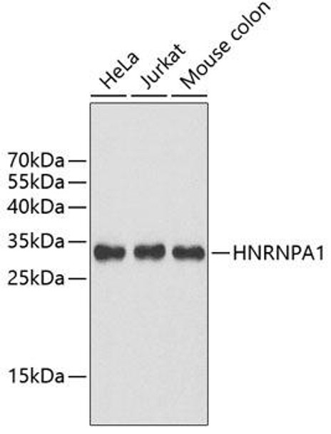 Anti-HNRNPA1 Antibody (CAB2622)