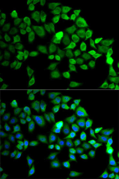 Anti-CUL2 Antibody (CAB2881)