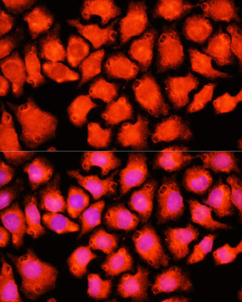 Anti-ACO2 Antibody (CAB3716)